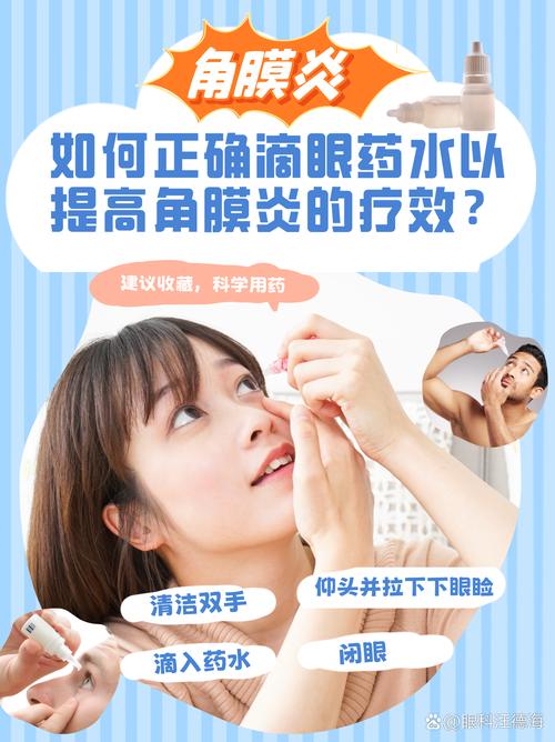 眼药水别直接滴眼球眼药水直接滴眼球可以吗
